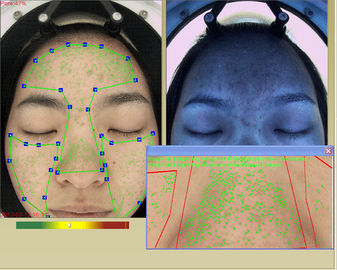 Lo strato portatile del derma del cosmetico dell'analisi della pelle e del terapista della pelle individua