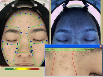 Cosmetici facendo uso della macchina di analisi della grinza 3D RGB + UV + spettri di PL 3