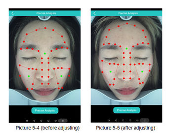 Nuvola potente della macchina di analisi della pelle di 3D Digital che divide il software di Android