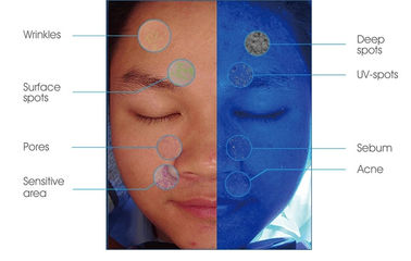 Analizzatore di idratazione della pelle della luce UV di RGB PL per rilevazione di problema di pelle