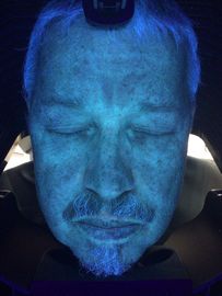 Macchina di diagnosi dell'analizzatore della pelle, analisi uv della pelle 3d