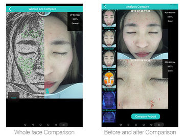 Problema intelligente dell'analizzatore 12skin della pelle individuato con la compressa 20 milione pixel