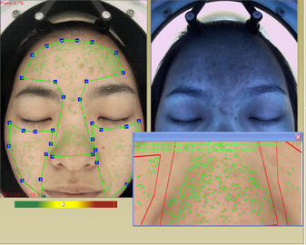 Macchina facciale professionale dell'analizzatore di idratazione della pelle 3d con il touch screen