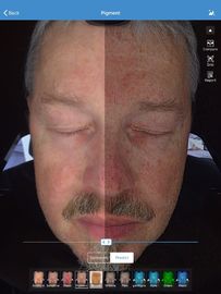 Stoccaggio facciale di Visia 32gb dell'analizzatore dell'analizzatore della pelle 3d per il dottore Skin Clinic