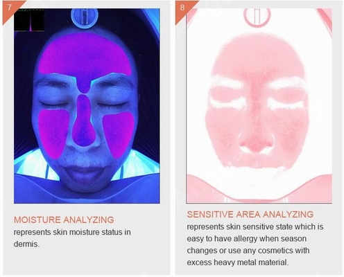Quiz astuti della macchina 3D dell'analizzatore della pelle dell'acne della pigmentazione della grinza di Skincare