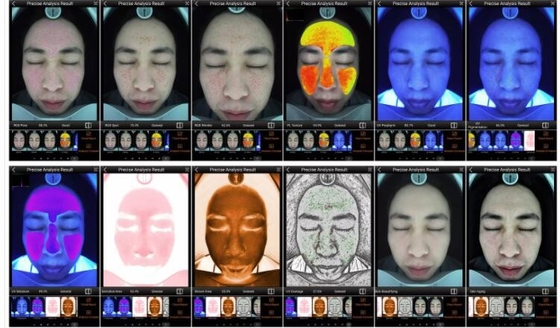 Analizzatore astuto UV della pelle di RGB PL