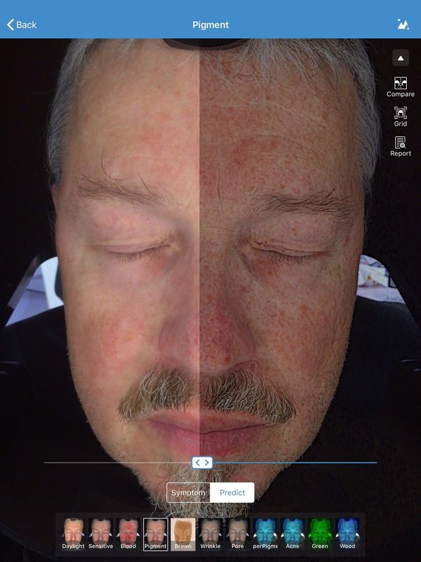 Stoccaggio facciale di Visia 32gb dell'analizzatore dell'analizzatore della pelle 3d per il dottore Skin Clinic